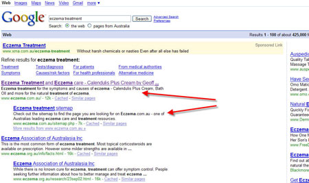 #1 for "Eczema Treatment" in Google